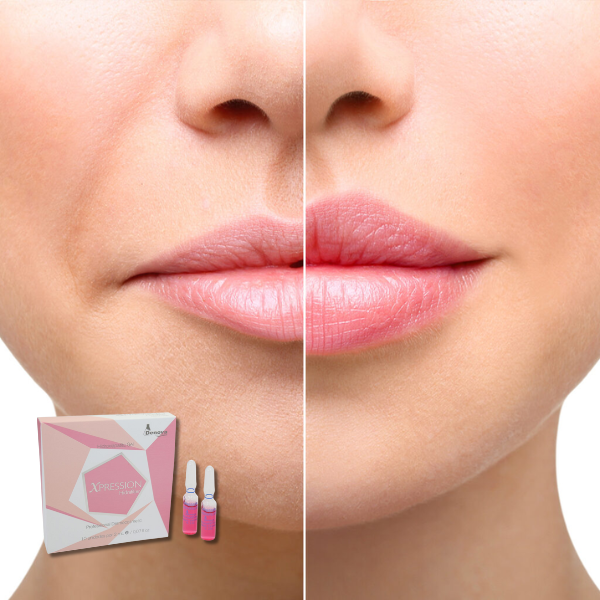 Xpression Hidrafiller – Skin Booster Reafirmante 10 Amp x 2 ml